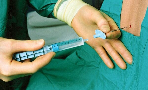 treatment of osteochondrosis by injections