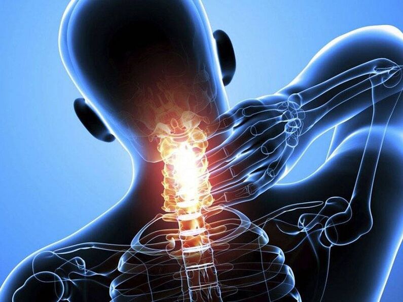 Osteochondrosis of the cervical spine is accompanied by pain in the neck