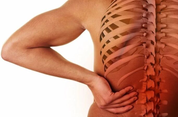Lumbar osteochondrosis