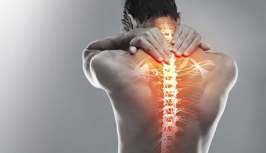 Neck osteochondrosis