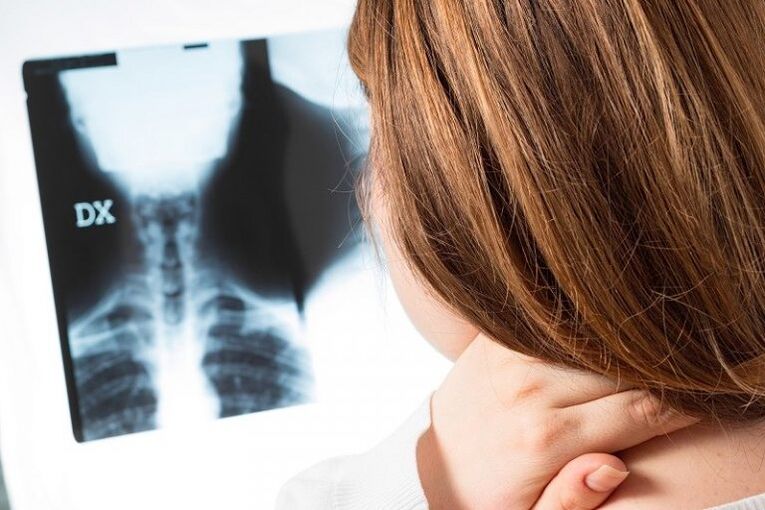 X-ray of the cervical region