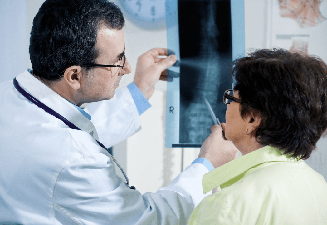 A neurologist diagnoses osteochondrosis using an x-ray of the spine